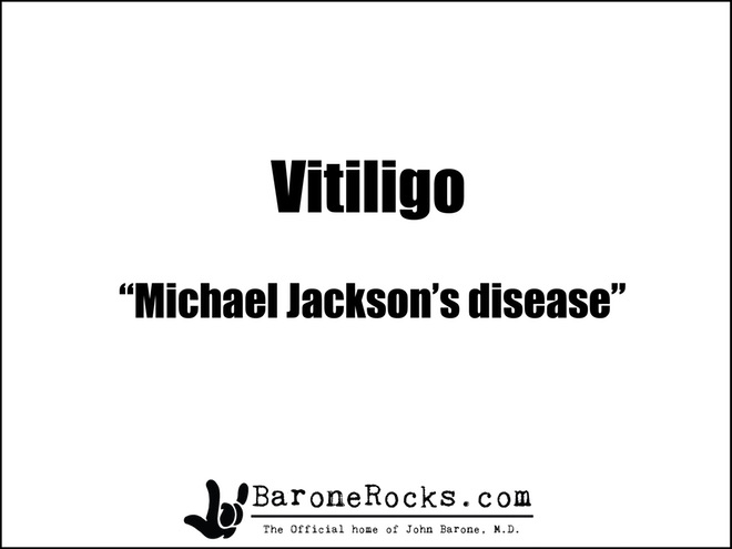 Vitiligo1