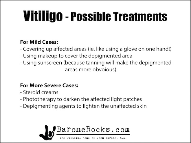 Vitiligo11