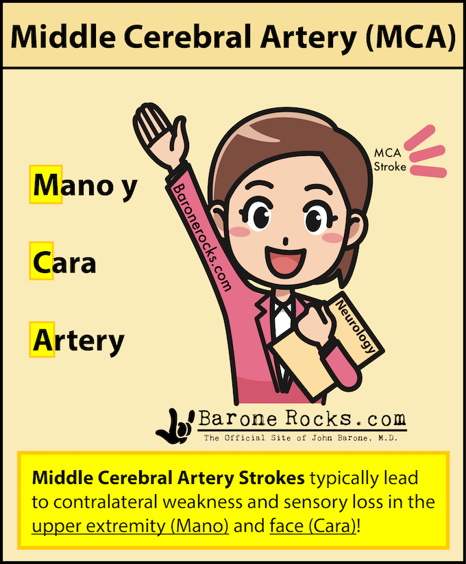 Middle Cerebral Artery Mca Stroke